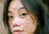 Nobody is born with freckles. The science behind these characteristic spots