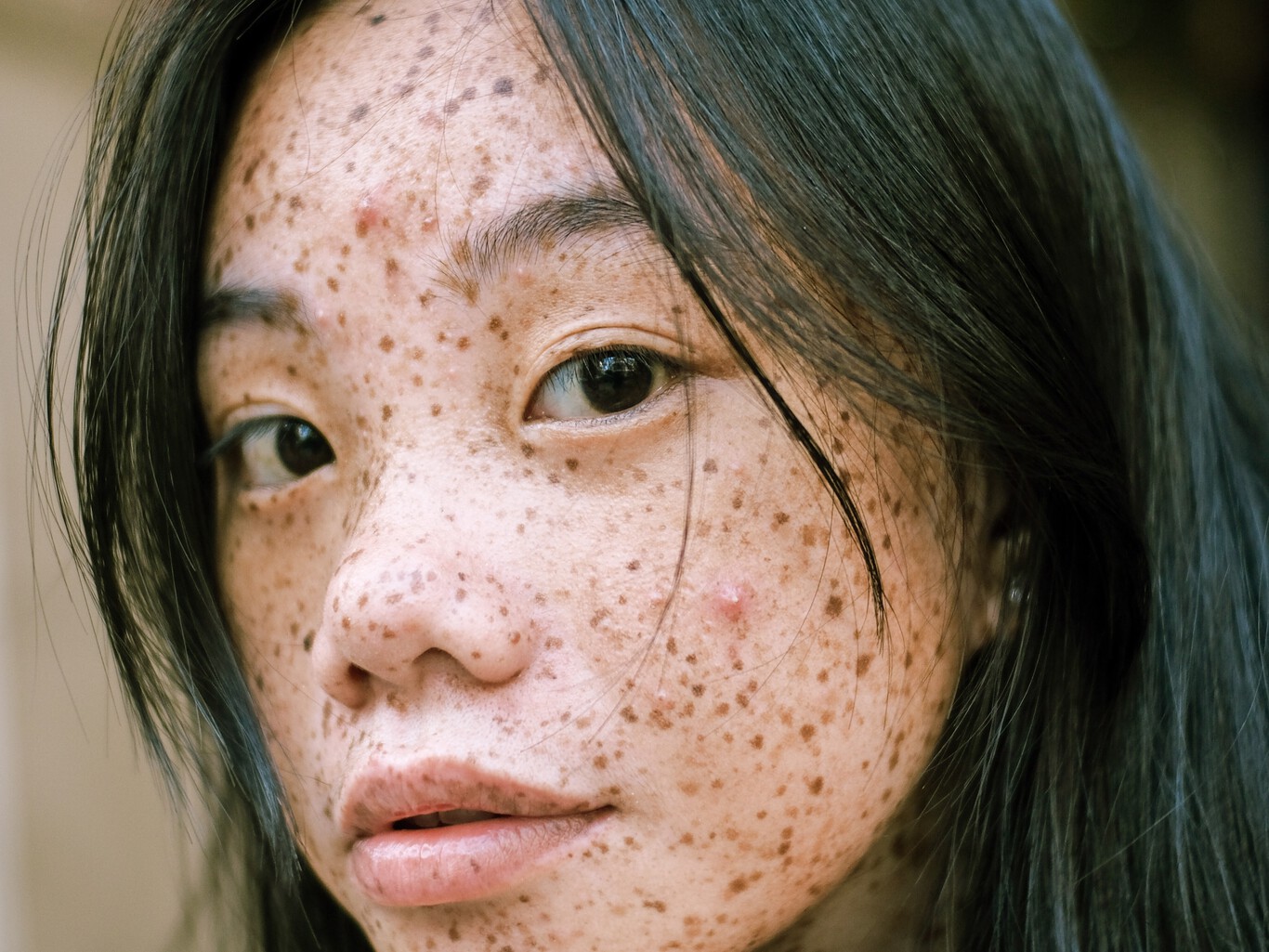 Nobody is born with freckles. The science behind these characteristic spots